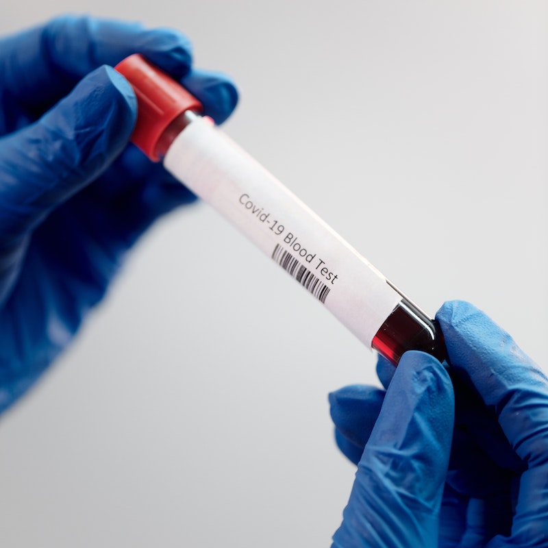 Virus Sampling